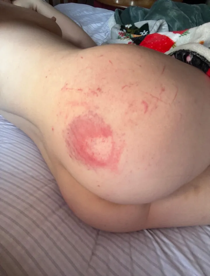 [F] I absolutely adore all of the pretty marks that come with impact
